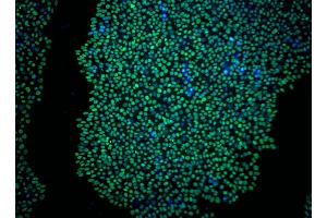 Immunoflourescent staining of Sox2 in human embryonic stem (ES) cells. (SOX2 抗体)
