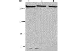 Western blot analysis of PC3, NIH/3T3 and HUVEB cell, using FLNA Polyclonal Antibody at dilution of 1:1100 (Filamin A 抗体)