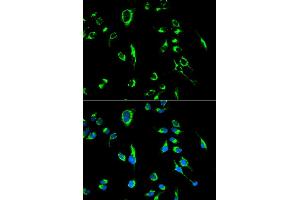 Immunofluorescence analysis of MCF-7 cells using APOBEC3G antibody. (APOBEC3G 抗体)