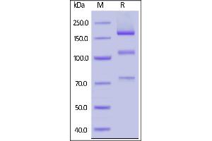SDS-PAGE (SDS) image for Complement Component 5 (C5) (AA 19-1678) protein (His tag) (ABIN6952281)