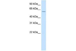 WB Suggested Anti-HOXD3 Antibody Titration:  0. (HOXD3 抗体  (C-Term))