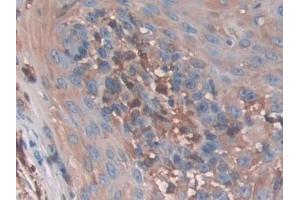 Immunohistochemistry (IHC) image for anti-Cofilin 1 (CFL1) (AA 3-161) antibody (ABIN7433783)