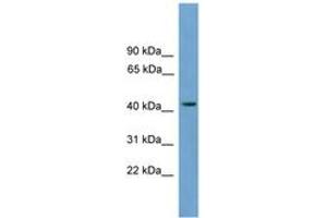 Image no. 1 for anti-Major Facilitator Superfamily Domain Containing 3 (MFSD3) (AA 179-228) antibody (ABIN6744914) (MFSD3 抗体  (AA 179-228))