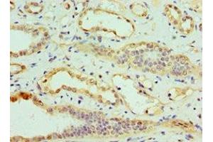 Immunohistochemistry of paraffin-embedded human kidney tissue using ABIN7147891 at dilution of 1:100 (CLDN14 抗体  (AA 140-239))
