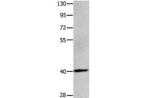 Western Blot analysis of Human brain glioma tissue using MAGEB4 Polyclonal Antibody at dilution of 1:550 (MAGEB4 抗体)
