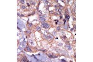 Image no. 1 for anti-TXK tyrosine Kinase (TXK) (N-Term) antibody (ABIN359999) (TXK 抗体  (N-Term))