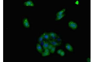 Immunofluorescent analysis of HepG2 cells using ABIN7143372 at dilution of 1:100 and Alexa Fluor 488-congugated AffiniPure Goat Anti-Rabbit IgG(H+L) (GPR124 抗体  (AA 1069-1338))