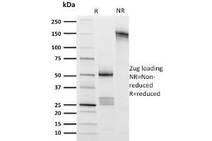SDS-PAGE Analysis Purified CD8 Mouse Monoclonal Antibody (UCHT4). (CD8 alpha 抗体)