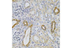 Immunohistochemistry of paraffin-embedded rat kidney using KRT20 Antibody. (KRT20 抗体  (AA 245-424))