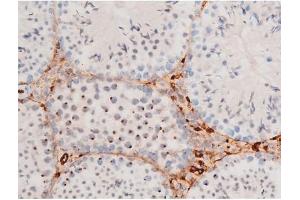Immunohistochemistry (IHC) image for anti-Forkhead Box O4 (FOXO4) (pSer197) antibody (ABIN6255069)