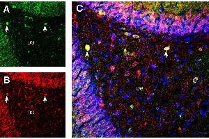 Multiplex staining of GluR1 and PICK1 in rat hippocampus. (Protein Interacting With Protein Kinase C, alpha 1 (PICK1) Peptide)
