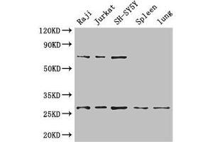 Western Blot Positive WB detected in: Raji whole cell lysate, Jurkat whole cell lysate, SH-SY5Y whole cell lysate, Mouse spleen tissue, Mouse lung tissue All lanes: YWHAZ antibody at 3. (14-3-3 zeta 抗体  (AA 133-212))