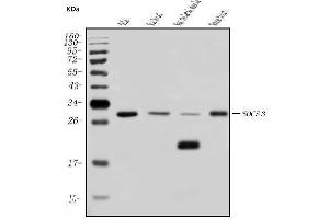 Western blot analysis of SOCS3 using anti-SOCS3 antibody (ABIN7599926).