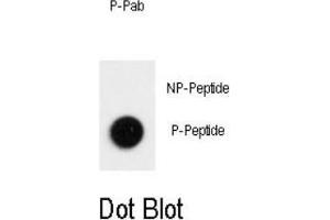Dot blot analysis of Phospho-LC3 (APG8b)- Thr12 Antibody  on nitrocellulose membrane.