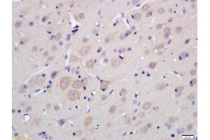 Formalin-fixed and paraffin embedded rat brain labeled with Anti-MOBP Polyclonal Antibody, Unconjugated  at 1:200 followed by conjugation to the secondary antibody and DAB staining. (MOBP 抗体  (AA 7-90))