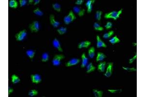 Immunofluorescence staining of Hela cells with ABIN7143811 at 1:133, counter-stained with DAPI. (ACTN1 抗体  (AA 1-204))