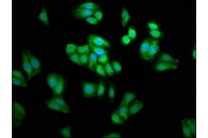 Immunofluorescence staining of HepG2 cells with ABIN7163417 at 1:66, counter-stained with DAPI. (PSAT1 抗体  (AA 104-206))