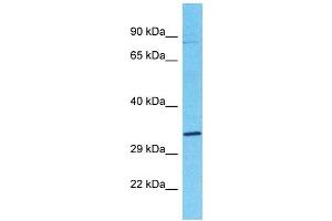 Host:  Rabbit  Target Name:  OS9  Sample Type:  Lung Tumor lysates  Antibody Dilution:  1. (OS9 抗体  (C-Term))