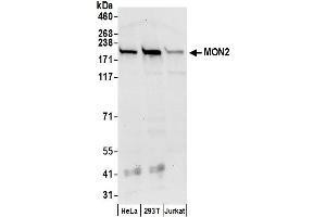 anti-MON2 Homolog (Mon2) (AA 1-50) antibody
