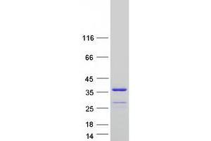 Validation with Western Blot