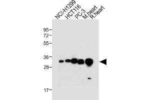 Western Blotting (WB) image for anti-Voltage-Dependent Anion Channel 2 (VDAC2) (AA 51-85), (N-Term) antibody (ABIN6242882)