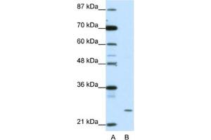 Western Blotting (WB) image for anti-Zinc Finger Protein 253 (ZNF253) antibody (ABIN2461909) (ZNF253 抗体)