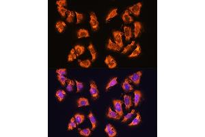 Immunofluorescence analysis of U2OS cells using alpha Sarcoglycan (alpha Sarcoglycan (SGCA)) Rabbit pAb (ABIN1682687, ABIN5664644, ABIN5664646 and ABIN6220497) at dilution of 1:100. (SGCA 抗体  (AA 60-290))