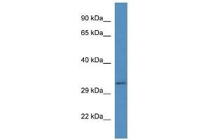 Western Blot showing Bend6 antibody used at a concentration of 1. (BEND6 抗体  (C-Term))