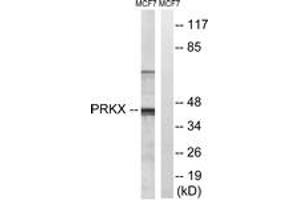 Western Blotting (WB) image for anti-Protein Kinase, X-Linked (PRKX) (AA 251-300) antibody (ABIN2890617) (PRKX 抗体  (AA 251-300))