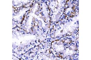IHC analysis of Claudin 7/CLDN-7 using anti-Claudin 7/CLDN-7 antibody (ABIN7602665). (Claudin 7 抗体  (AA 92-211))