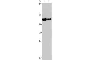 Gel: 6 % SDS-PAGE, Lysate: 40 μg, Lane 1-2: Hela cells, A172 cells, Primary antibody: ABIN7191819(PDE4A Antibody) at dilution 1/300, Secondary antibody: Goat anti rabbit IgG at 1/8000 dilution, Exposure time: 20 seconds (PDE4A 抗体)