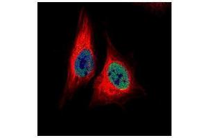 ICC/IF Image Confocal immunofluorescence analysis (Olympus FV10i) of paraformaldehyde-fixed HeLa, using TEAD4, antibody (Green) at 1:500 dilution. (TEAD4 抗体  (Center))