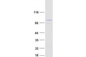 Validation with Western Blot