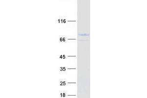 Validation with Western Blot (MID1 Protein (Transcript Variant 3) (Myc-DYKDDDDK Tag))