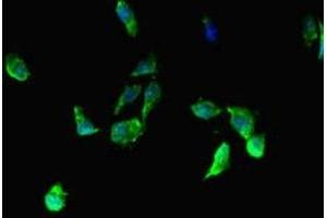 Immunofluorescent analysis of Hela cells using ABIN7145808 at dilution of 1:100 and Alexa Fluor 488-congugated AffiniPure Goat Anti-Rabbit IgG(H+L) (BRD3 抗体  (AA 356-506))