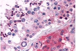 Anti-ELOVL5 antibody  ABIN1048538 IHC staining of human testis. (ELOVL5 抗体  (C-Term))