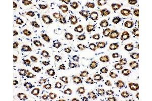 Immunohistochemistry (IHC) image for anti-Succinate Dehydrogenase Complex, Subunit C, Integral Membrane Protein, 15kDa (SDHC) (N-Term) antibody (ABIN3032765)