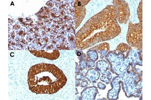 Immunohistochemical staining (Formalin-fixed paraffin-embedded sections) of human pancreas (A), human colon carcinoma (B), human cervical carcinoma (C) and human placenta (D) with MAML3 monoclonal antibody, clone MAML3/1303 . (MAML3 抗体)