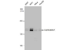 Western Blotting (WB) image for anti-Protein Tyrosine Phosphatase F Interacting Protein 1 (PPFIA1) (N-Term) antibody (ABIN2856986)