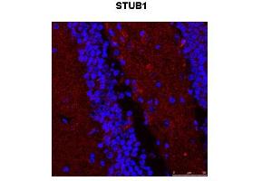 Immunohistochemistry (IHC) image for anti-STIP1 Homology and U-Box Containing Protein 1 (STUB1) (N-Term) antibody (ABIN2774916)