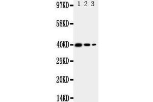 Western Blotting (WB) image for anti-Translocation Associated Membrane Protein 2 (TRAM2) (AA 309-325), (C-Term) antibody (ABIN3044050) (TRAM2 抗体  (C-Term))