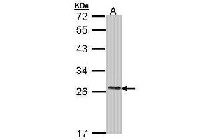 WB Image Sample (30 ug of whole cell lysate) A: Molt-4 , 12% SDS PAGE antibody diluted at 1:1000 (COMT 抗体)