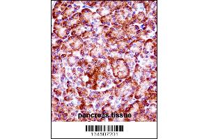 RIPK3 Antibody immunohistochemistry analysis in formalin fixed and paraffin embedded human pancreas tissue followed by peroxidase conjugation of the secondary antibody and DAB staining.