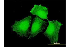 Immunofluorescence of purified MaxPab antibody to CEP57 on HeLa cell. (CEP57 抗体  (AA 1-500))