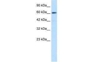Western Blotting (WB) image for anti-Zinc Finger and BTB Domain Containing 45 (ZBTB45) antibody (ABIN2460149) (ZBTB45 抗体)