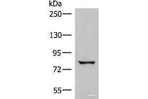 Western blot analysis of Human bladder transitional cell carcinoma grade 2-3 tissue lysate using TTC12 Polyclonal Antibody at dilution of 1:300 (TTC12 抗体)