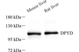 Western blot analysis of DPD (ABIN7073735),at dilution of 1: 600 (DPYD 抗体)