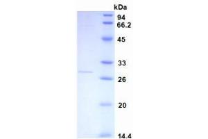 SDS-PAGE analysis of recombinant Human CRP. (CRP 蛋白)