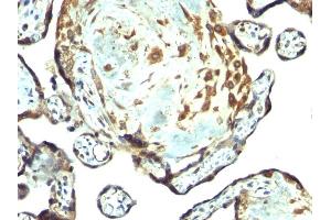 Formalin-fixed, paraffin-embedded human placenta stained with TIMP3 Rabbit PAb. (TIMP3 抗体  (AA 175-211))