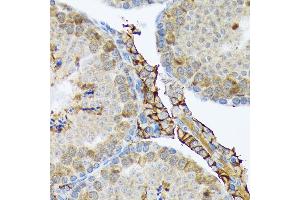 Immunohistochemistry of paraffin-embedded mouse testis using PLTP Rabbit mAb (ABIN7269357) at dilution of 1:100 (40x lens). (PLTP 抗体)